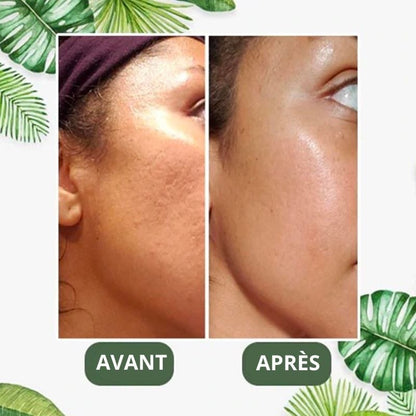 TeaMask™ - Masque Purifiant Detox au Thé Vert