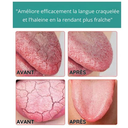 OralMint™ - Essence de Soins Bucco-Dentaires Haleine Fraîche